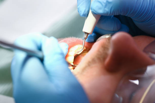 Best Knocked-Out Tooth Emergency  in Oakwood Hls, IL