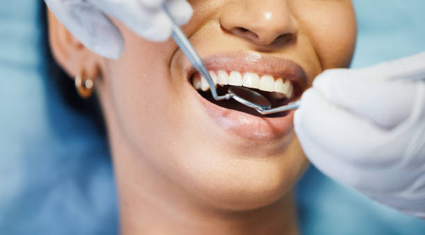 Best Cracked Tooth Emergency Dentist  in Oakwood Hls, IL