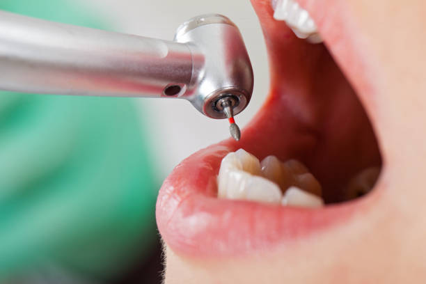 Best Root Canal Emergency Dentist  in Oakwood Hls, IL